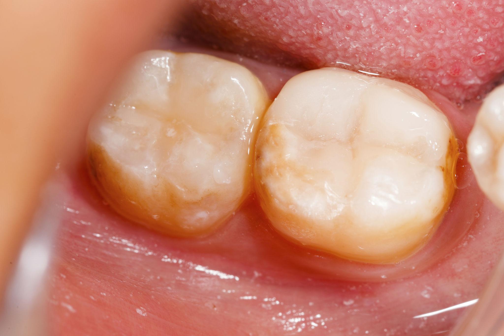 Restorative Dentistry